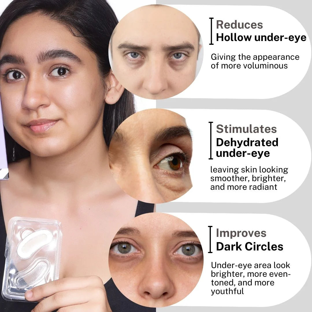 Microneedle Under Eye Patches